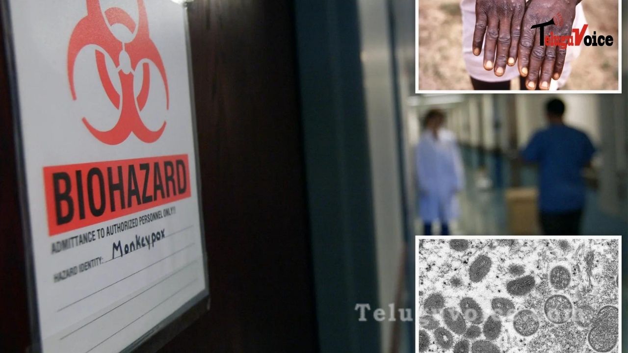 US: A Case Of Monkeypox Confirms! teluguvoice
