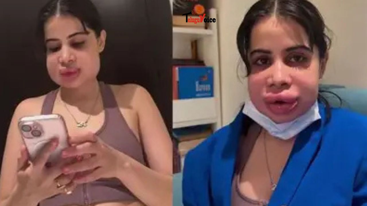 Uorfi Javed Reveals Swollen Face After Lip Filler Removal, Shares Candid Health Update  teluguvoice